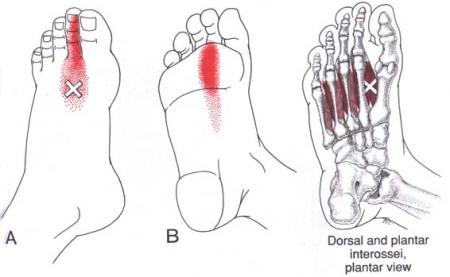 myofascia compartments of leg