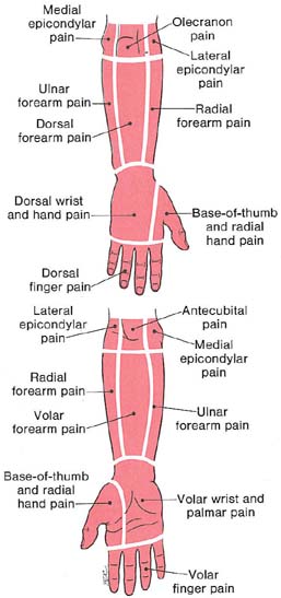 Forearm And Hand Pain The Trigger Point And Referred Pain Guide